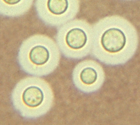 Cryptococcus neoformans (Tuschepräparat)